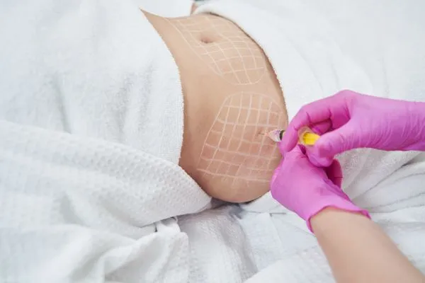 image of fat dissolving injections on love handles to help combat weight gain Orrell