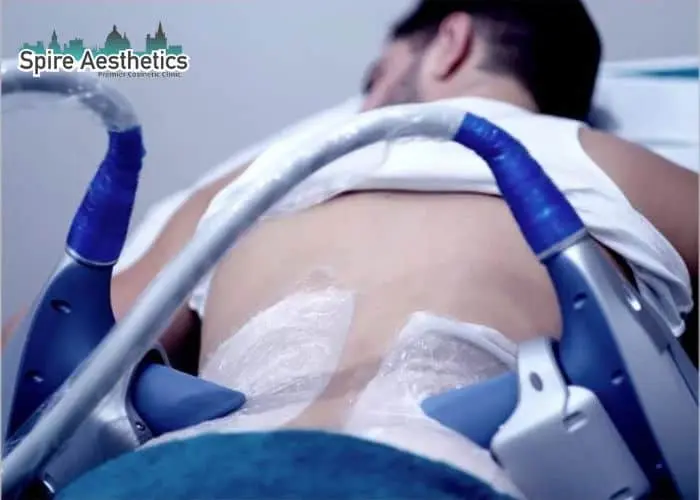 Man having fat freezing treatment done on love handles before a competitions Orrell to create a sculpted look.